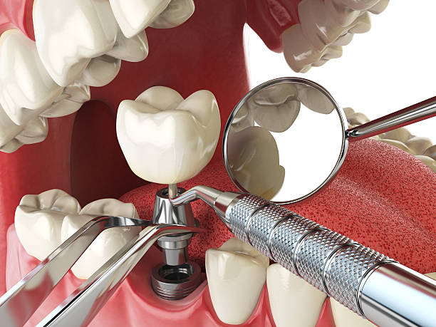 Best Emergency Orthodontic Repairs in Due West, SC
